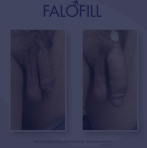 image3 copiar