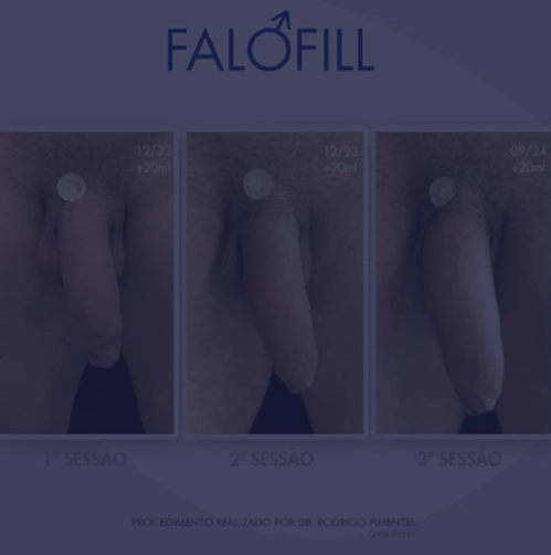 image4 copiar